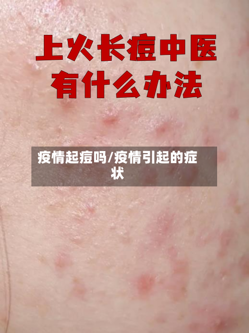 疫情起痘吗/疫情引起的症状-第3张图片